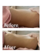 オン 絹(on silk)/腸もみ/1回/オプション