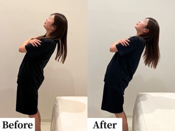 ソレア(Solea)/反り腰・腰痛改善1回目