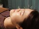 朗快鍼灸マッサージ院【鍼灸/美容鍼/肩こり/腰痛/桜台・練馬駅】の写真