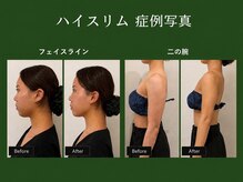 ハイコガオ 中崎町店(HIKOGAO)の雰囲気（自信を持てるラインに）