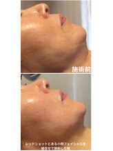 サロンドエムジョリー 横浜(Salon de M jolie)