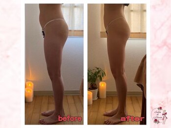 サロンドモアロ(Salon de Moaro)/Before/After