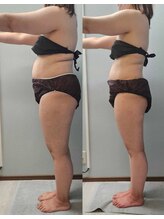 ルミルナ(Lumi Luna)/－10kg達成！！