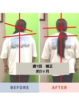 北てんま整骨鍼灸院/軸のズレと猫背を矯正！