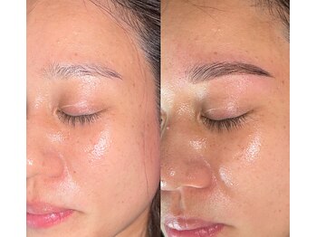 ベイビーワクシング(baby waxing)/11【眉から変わる】