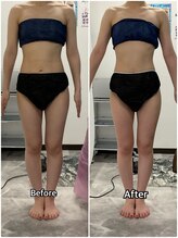 輝 らいと/ビフォーアフター（正面）