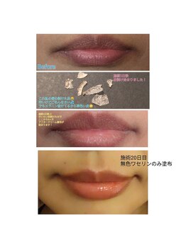 エステティックサロン やまとなでしこ/Roma Pink☆リップ