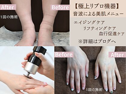 ルシェルアイの写真