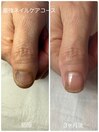 最強ネイルケアコース