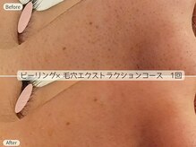 エントテ(en to Te)