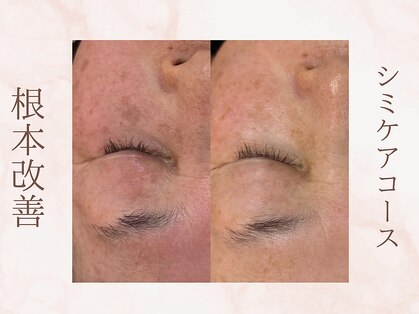 ココンフワット (Coconhouwat)の写真