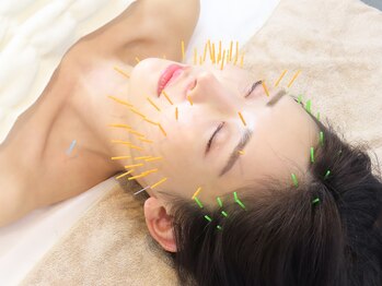 ハリックマ(HARICCUMA)の写真/《リフトアップ美容鍼》内側から美しく、弾力のあるぷるぷる肌に☆むくみ改善にも◎是非一度お試し下さい♪