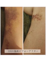 賢者のボディケア/術後ケア◎