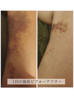 賢者のボディケア/術後ケア◎