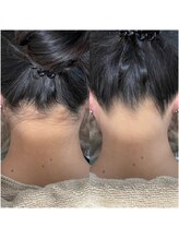 ミーミドットアイ(Mi-mi.i)/成人式★うなじワックス脱毛