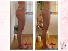 サロンドモアロ(Salon de Moaro)/Before/After