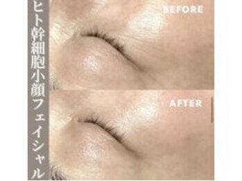 スキンベイビー 池袋店(Skin Baby)/目元の気になるシワもケア！！
