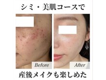 パタティパタタ(PatatiPatata)