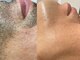 ルミエール(Lumiere)の写真/1席のみのプライベートサロンで恥ずかしくない☆40代・50代～始める方も増えています。痛みの少ない脱毛☆