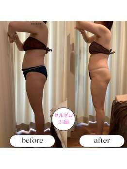 キュール(KuhL)/50代痩身ビフォーアフター☆