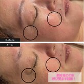ビューティーサロンエイト(Beauty Salon8)