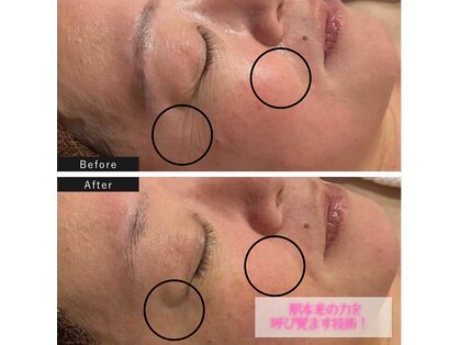 ビューティーサロンエイト(Beauty Salon8)の写真