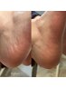 サンダル準備してる？【とぅるとぅる足裏ケア 】高級オーガニックSPA¥4400→
