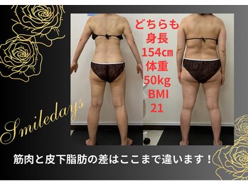 スマイルデイズ(Smiledays)/皮下脂肪は1.3倍大きく見える！
