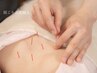 【慢性症状改善】からだの鍼灸80分￥6300｜初回セルフケアセット付