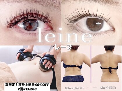 ラ レーヌ(La-leine)の写真