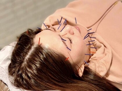 紬はりきゅう接骨院の写真