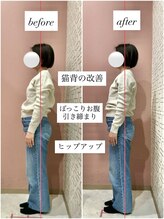 ユルル 刈谷店(Yururu)/before・after（骨盤整体）