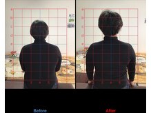 ストレチックス 近江八幡店/頭痛に悩む肩こり撃破！！