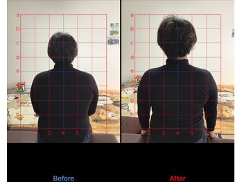 ストレチックス 近江八幡店/頭痛に悩む肩こり撃破!!