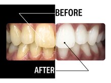 ルナベル(Luna Bell)の雰囲気（累計症例実績5万件！医療提携の安心セルフホワイトニング）