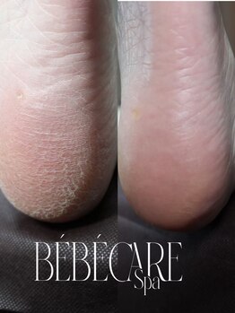 NailSalon＆School　Hocus Pocusの写真/べべケアスパや本格角質除去、リフレクソロジーができる♪角質ケアサロン☆