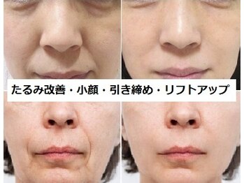 ナチュレアンドメディカ(Nature&Medica)の写真/エステ唯一の圧倒的な効果＆瞬間小顔！最先端オンダリフト、韓国美容ソフウェーブ、最高峰ウルトラリフト