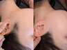 うなじ+もみあげワックス脱毛