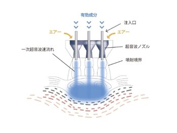 ルーク 相馬店(Luke)/◆ニードルレスインジェクター◆