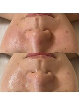 ウルス(ulus)/アンストレス