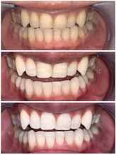 ライトビューティー 池袋店(LightBeauty)/症例写真