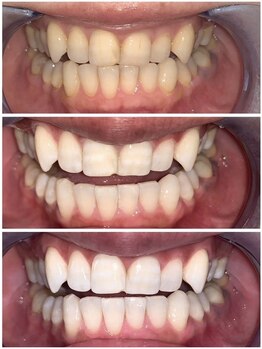 ライトビューティー 池袋店(LightBeauty)/症例写真