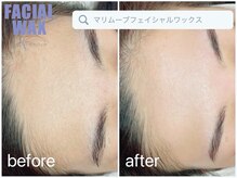 アイラッシュ モコ(eyelash moco)/艶肌改善【所沢脱毛】