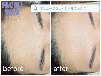 アイラッシュ モコ(eyelash moco)/艶肌改善【所沢脱毛】