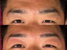 リジュベ(Rejuve)/メンズアイブロウ［まゆ毛］