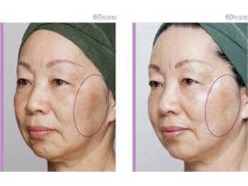 フルールドリス(FLEUR DE LIS)/毛穴洗浄でごっそりツルピカ肌に