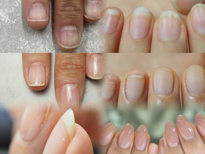 フォーエバー(4ever...u)の写真