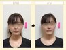 【頭の重ダルさ&フェイスラインスッキリ♪】Corona式小顔矯正 初回体験15000