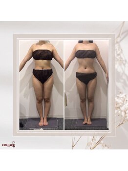 効くラボ 梅田店/1ヶ月で-2キロ！全身120分痩身★