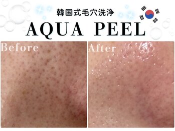 ヘティ バイ ソウル 中目黒(HETIY by Seoul)の写真/《韓国直輸入機器使用》韓国式毛穴洗浄*水光アクアピール☆毛穴に美容液導入◎内側から潤い溢れる水光肌○*